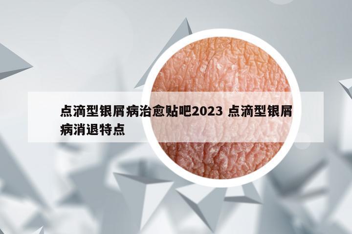 点滴型银屑病治愈贴吧2023 点滴型银屑病消退特点