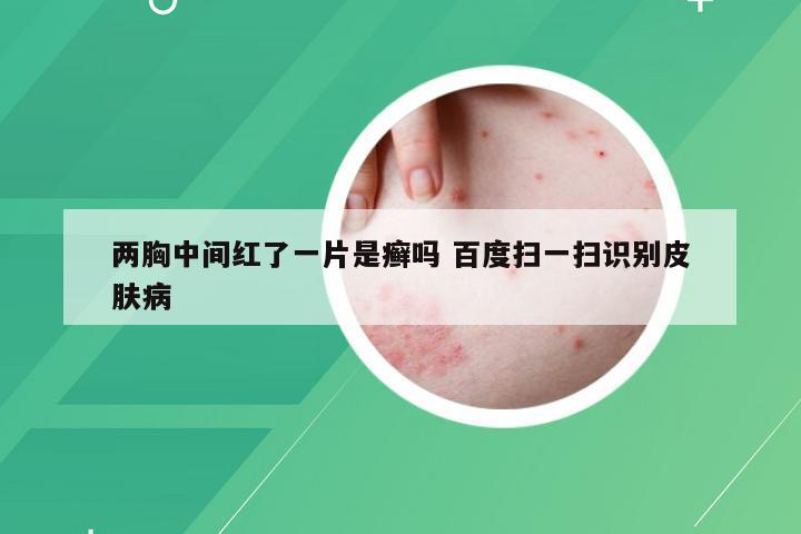 两胸中间红了一片是癣吗 百度扫一扫识别皮肤病