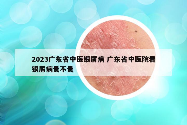 2023广东省中医银屑病 广东省中医院看银屑病贵不贵