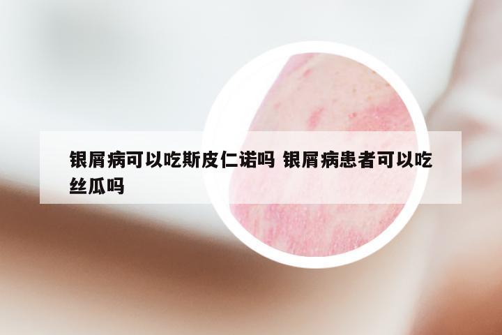 银屑病可以吃斯皮仁诺吗 银屑病患者可以吃丝瓜吗