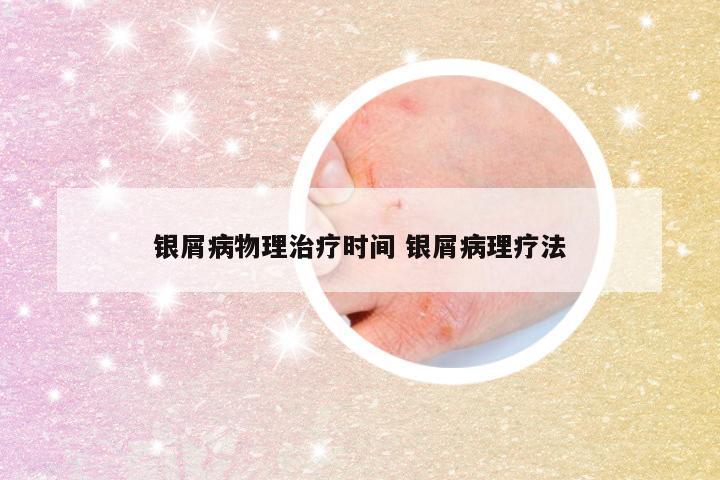 银屑病物理治疗时间 银屑病理疗法