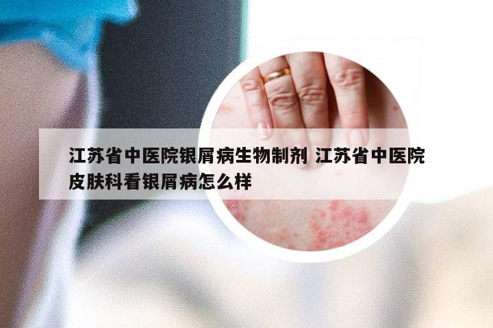 江苏省中医院银屑病生物制剂 江苏省中医院皮肤科看银屑病怎么样