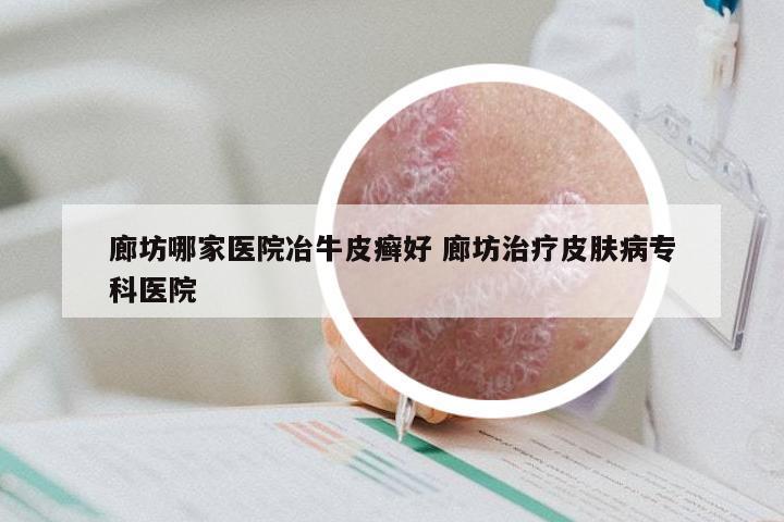 廊坊哪家医院冶牛皮癣好 廊坊治疗皮肤病专科医院