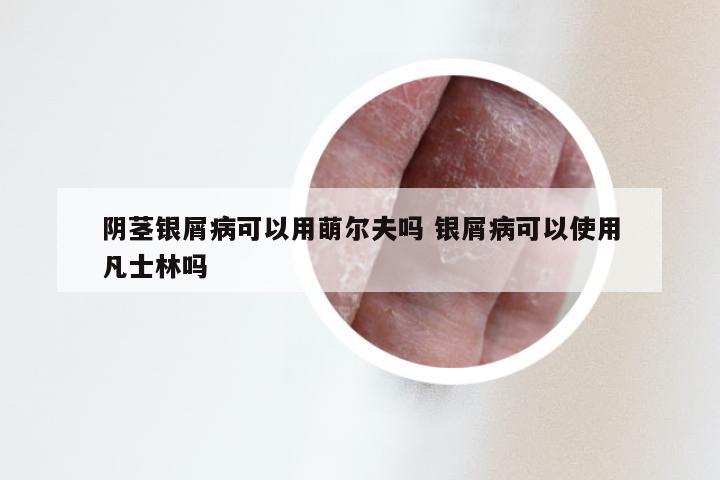 阴茎银屑病可以用萌尔夫吗 银屑病可以使用凡士林吗