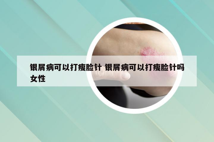 银屑病可以打瘦脸针 银屑病可以打瘦脸针吗女性