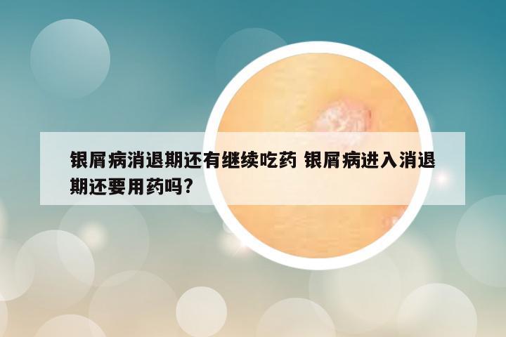 银屑病消退期还有继续吃药 银屑病进入消退期还要用药吗?