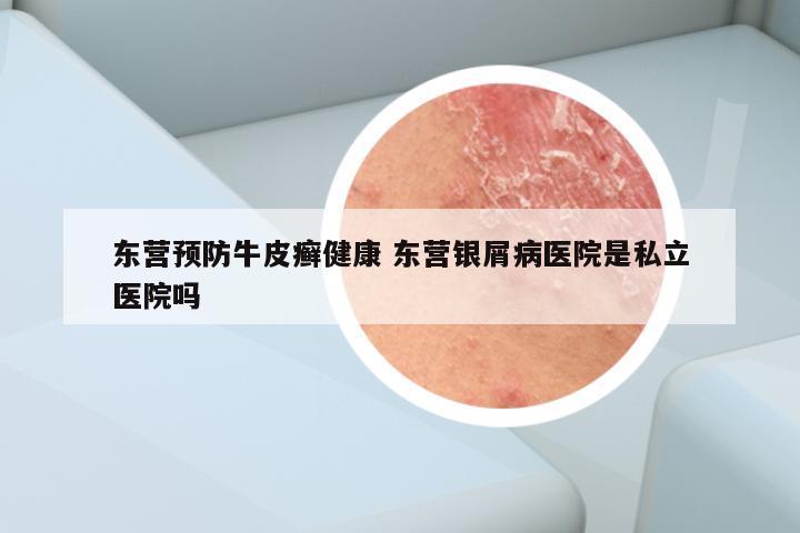 东营预防牛皮癣健康 东营银屑病医院是私立医院吗