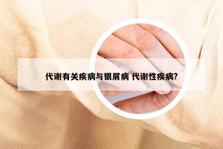 代谢有关疾病与银屑病 代谢性疾病?