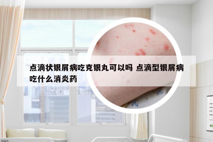 点滴状银屑病吃克银丸可以吗 点滴型银屑病吃什么消炎药