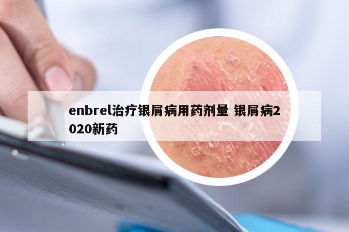 enbrel治疗银屑病用药剂量 银屑病2020新药