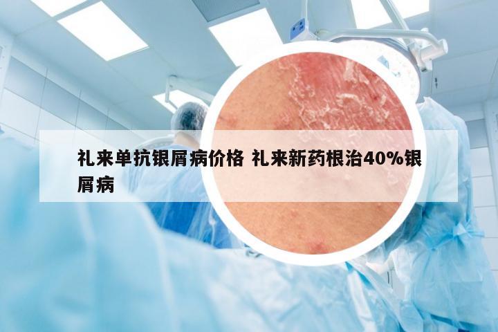 礼来单抗银屑病价格 礼来新药根治40%银屑病